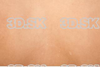 Skin texture of Della 0003